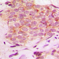 Anti-Mammaglobin A Antibody