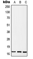 MGST2 Rabbit Polyclonal Antibody