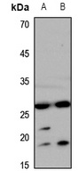 Aquaporin 0 Rabbit Polyclonal Antibody