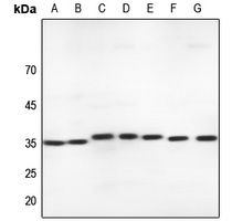 MLF1 Rabbit Polyclonal Antibody