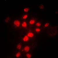 Anti-MLH1 Antibody