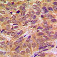 FOXO4 (phospho-S197) antibody