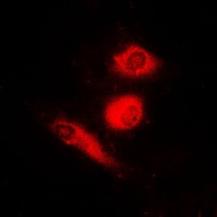 Anti-FOXO4 (Phospho-S197) Antibody