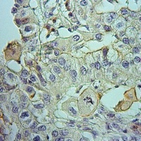 MMP1 antibody