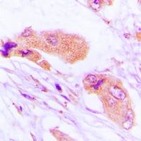 Anti-MMP1 Antibody
