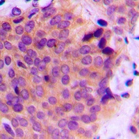 Anti-MMP2 Antibody