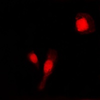 Anti-MMP2 Antibody
