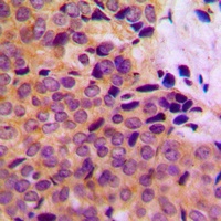 Anti-MMP8 Antibody