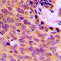 Anti-MMP9 Antibody