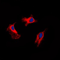 Anti-MMP9 Antibody