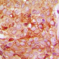 Anti-MMP11 Antibody