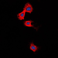 Anti-MMP11 Antibody