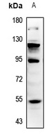 MMP12 Antibody