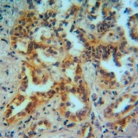 Anti-MMP12 Antibody