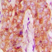 Anti-MMP13 Antibody