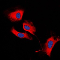 Anti-MMP13 Antibody