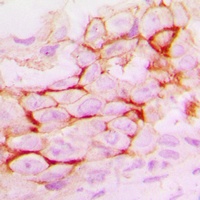 Anti-MMP14 Antibody