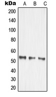 MMP14 Rabbit Polyclonal Antibody