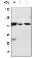 MMP15 Antibody