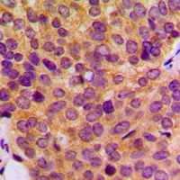 MMP19 Antibody