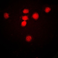 MRE11A antibody