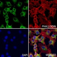 Anti-ATP6 Antibody