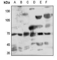 Myotubularin Rabbit Polyclonal Antibody