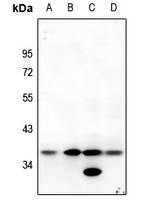 MT-ND1 Antibody