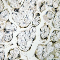 Anti-MT-ND1 Antibody