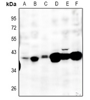 MT-ND2 Antibody