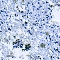 Anti-MT-ND2 Antibody