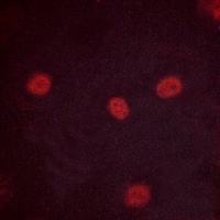 MYBL2 (phospho-S577) antibody