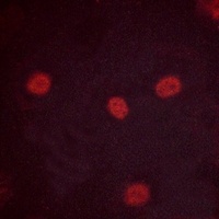 Anti-MYBL2 (Phospho-S577) Antibody