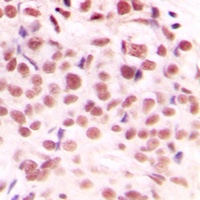 Anti-c-Myc (Phospho-S62) Antibody