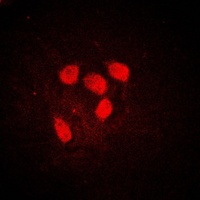 MYC (phospho-S62) antibody