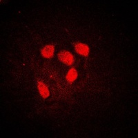 Anti-c-Myc (Phospho-S62) Antibody