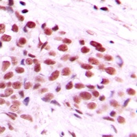 c-Myc (phospho-T58) antibody