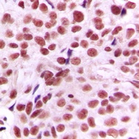 c-Myc Rabbit Polyclonal Antibody