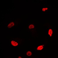 MYC antibody