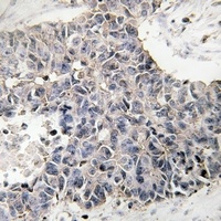 Anti-NBL1 Antibody