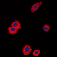 Anti-NBL1 Antibody