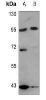 Nibrin Antibody