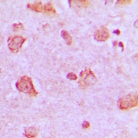Anti-NDUFA4 Antibody