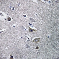 Anti-NDUFV2 Antibody