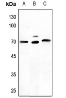 NEFL Antibody