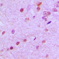 Anti-NEUROD2 Antibody