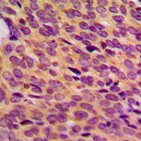 Anti-NF1 Antibody