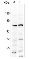 NRF2 Rabbit Polyclonal Antibody