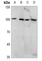 NF-kappaB p105 (Phospho-S927) Antibody