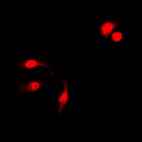 NFKB1 (phospho-S927) antibody